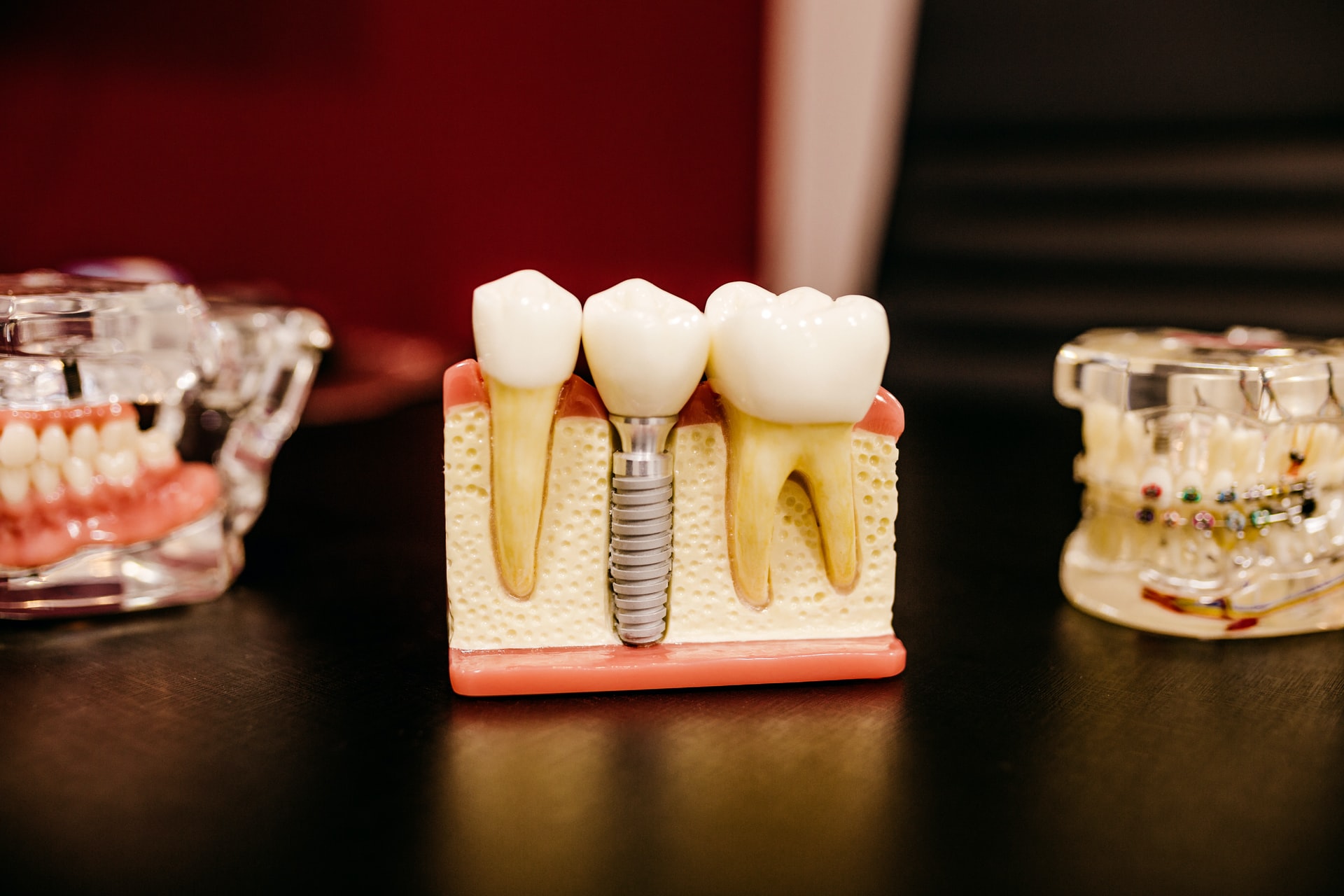 best dentist in reno nv, dental implants reno, reno cosmetic dentist