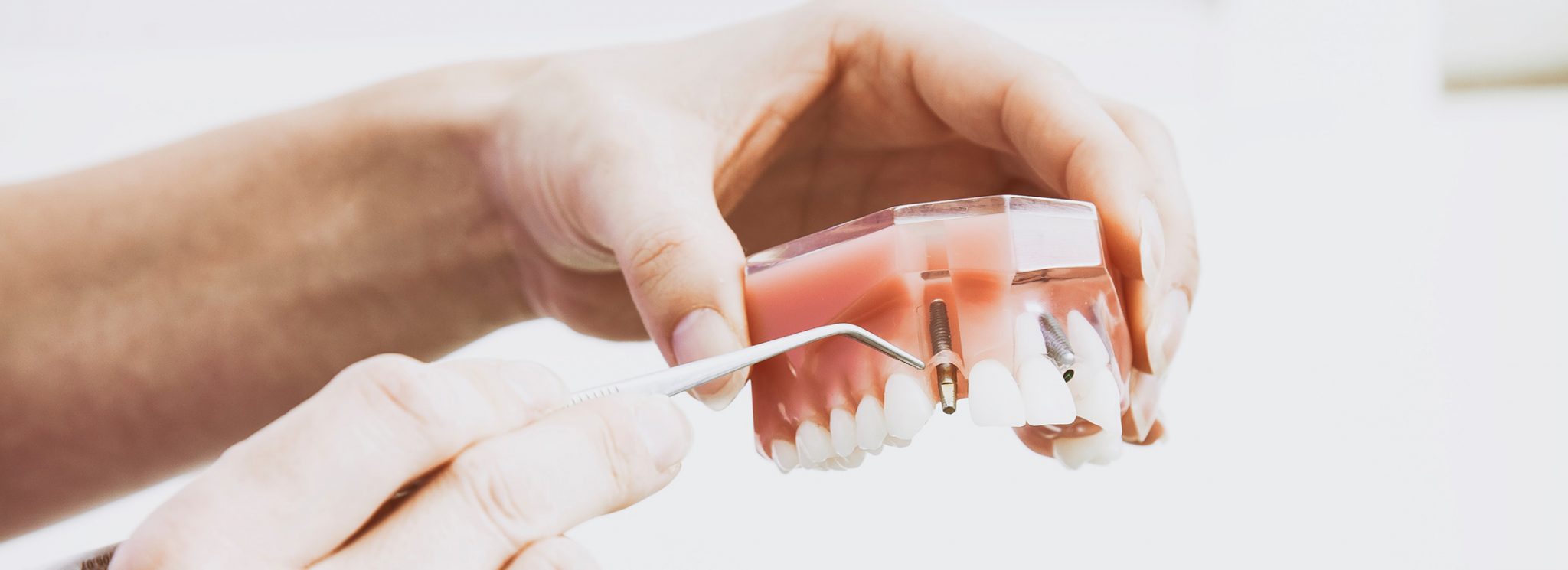What to Know When Selecting a Reno Cosmetic Dentist