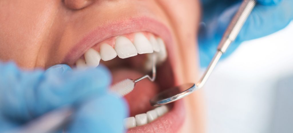 dental implants reno, best dentist in reno nv, best dentist in reno, facts about teeth