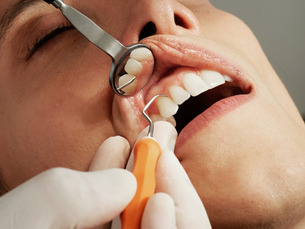 cosmetic dental services